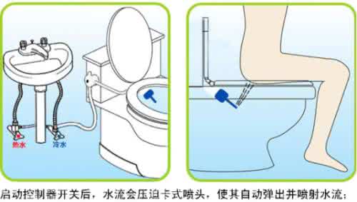 屁眼痒痒涂什么药好 屁眼一直痒痒怎么回事？