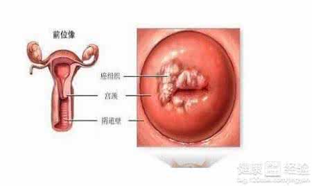 下体出现褐色分泌物 阴部怎么会有褐色分泌物