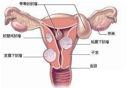 宫颈粘连的原因 宫颈粘连 宫颈粘连的发病原因