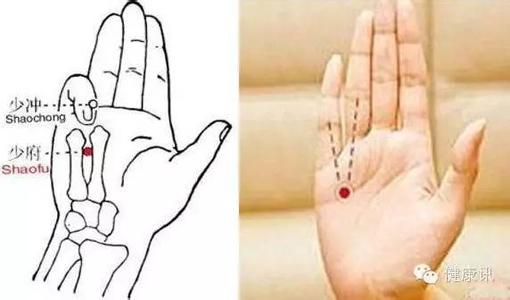 居家拔罐治疗早泄穴位有哪些