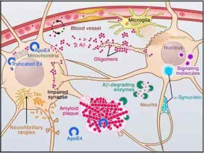 阿尔茨海默症药物 国内抗阿尔茨海默症药物三大主力走势