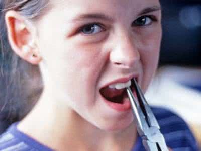 牙痛该怎么办 牙痛该怎么办 牙痛怎么办