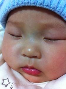 宝宝鼻梁青筋怎么回事 宝宝鼻梁青筋怎么治疗 鼻梁低怎么治疗护理