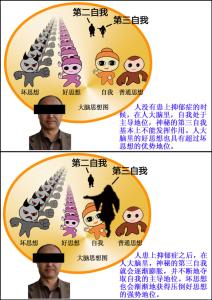 对抗抑郁症最好的方法 对抗抑郁症最好的方法 抑郁症怎么办 5种方法帮你有效对抗抑郁症