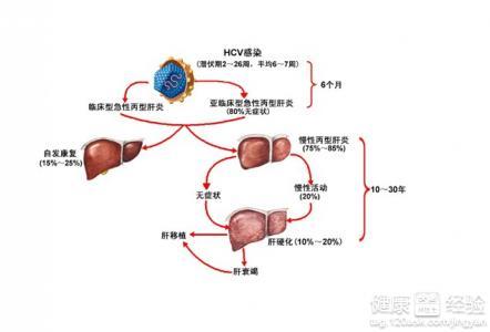 病毒性肝炎的预防措施 丙型病毒性肝炎 丙型病毒性肝炎如何预防