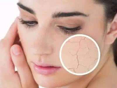 皮肤粗糙的原因 皮肤粗糙的原因 皮肤粗糙的原因