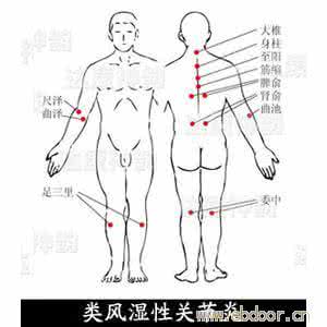 类风湿关节炎除根偏方 类风湿关节炎的诱因 简单4个因素导致类风湿