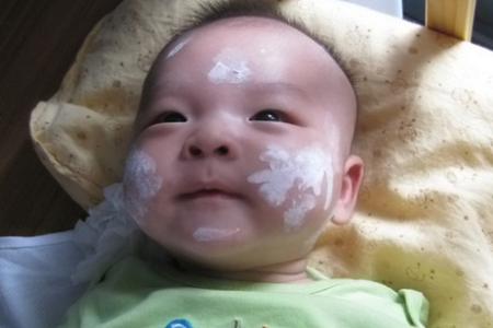 新生儿出湿疹怎么办 新生儿湿疹可以洗脸吗 新生儿出湿疹能洗脸吗？