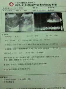 胎心率正常值 怀孕38周胎心率正常值 怀孕38周彩超正常值