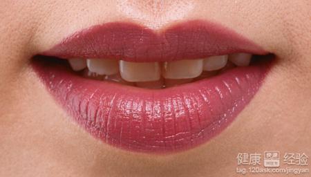 嘴唇湿疹和唇炎的别 嘴唇湿疹和唇炎的别 咬嘴唇得了唇炎怎么办？