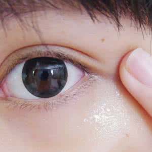 眼部脂肪粒怎么去除 眼部脂肪粒 眼部肌肤的脂肪粒怎么去除