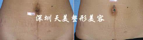 普法栏目剧婚姻保鲜膜 舍弃陈旧,婚姻也需要“保鲜”