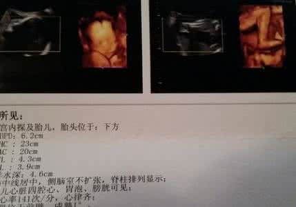 四维彩超看不清颜面部 四维彩超看不清颜面部 四维臀位看不清怎么办?
