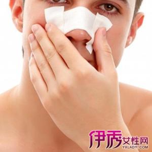 鼻子出血怎么快速止血 鼻子出血快速止血 怎么让鼻子快速出血？