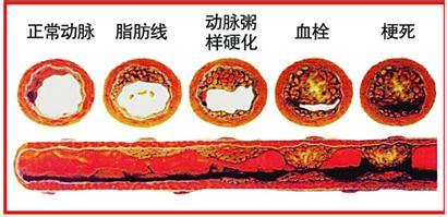 打通血管绝密偏方 绝密偏方：打通血管最佳选择！见议收藏造福人类