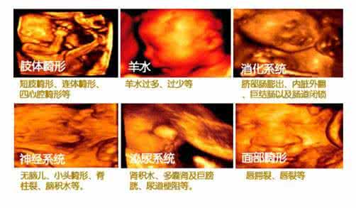 四维彩超一定要做吗 四维彩超一定要做吗 准妈妈一定要收藏，史上最全四维彩超数据解读