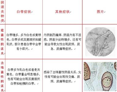 有什么土方法治疗霉菌 霉菌性阴道炎该怎么治疗