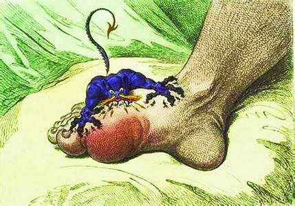 人类的最终归宿 人最终的归宿 手术，是痛风的最终归宿吗？