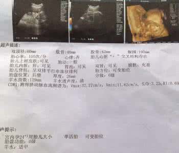 b超单数据怎么看 b超单怎么看 b超单怎么看 如何看b超数据