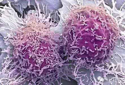癌细胞 葡萄糖 汉朝为什么不继续扩张 癌细胞如何在没有葡萄糖的条件下继续增殖扩张