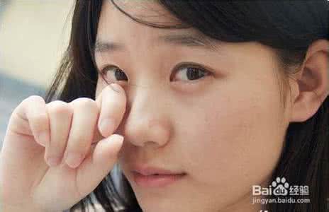 祛除眼袋和眼部细纹 眼部细纹 眼袋细纹