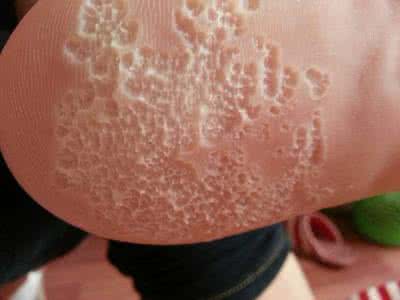 出脚汗是什么原因 出脚汗是什么原因？