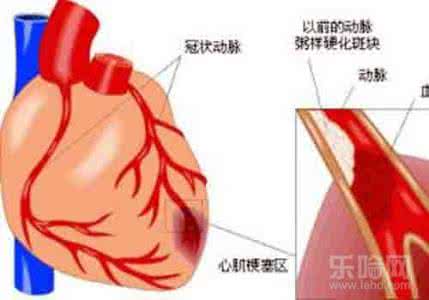 心肌炎能治好吗 心肌炎能治好吗 你了解心肌炎吗