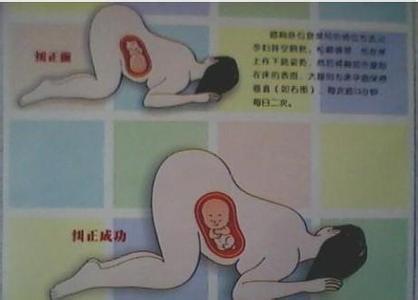 预防胎位不正的睡姿 如何预防胎位不正