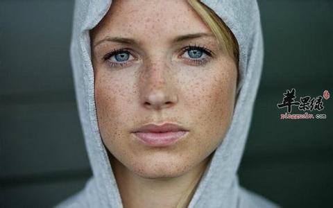 祛色斑的有效方法 去掉脸上色斑的方法 脸上的斑怎么去掉?什么方法有效又安全