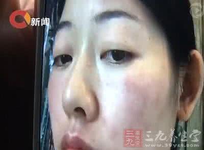 影楼艺术照样片 女子上影楼拍摄艺术照 面部过敏险“毁容”