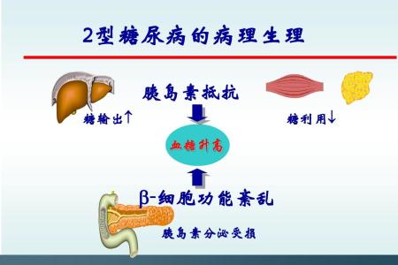 糖尿病口服胰岛素 口服胰岛素可预防1型糖尿病高危儿童发病