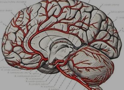 怎样预防脑血管疾病 健康自测：怎样预知脑血管疾病