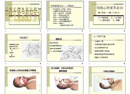 中学生急救常识 中学生急救常识 中学生急救常识主要有哪些呢