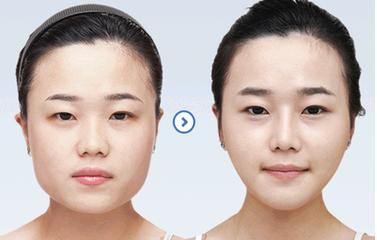 如何瘦脸改脸型 不同脸型瘦脸技巧
