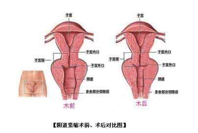 私密保养的十大好处 私密之处正常的阴道是什么颜色