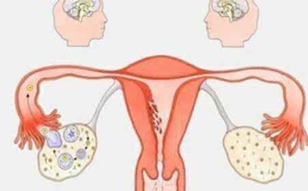 多囊卵巢综合症闭经 多囊性卵巢综合症 预防多囊卵巢综合症