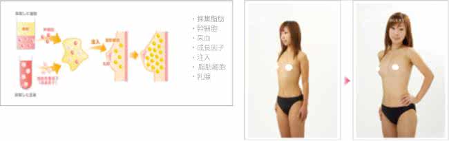 如何减掉大腿部赘肉 胸部多余脂肪怎么减掉 极速燃烧大腿多余脂肪,让你拥有纤细美腿