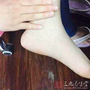 湿疹部位变硬块 【一点资讯】男女这个部位变硬暗示衰老 (Yidianzixun.com)