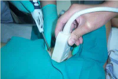 甲状腺结节普遍吗 体检发现甲状腺结节怎么处理？这个问题非常普遍，值得一看！