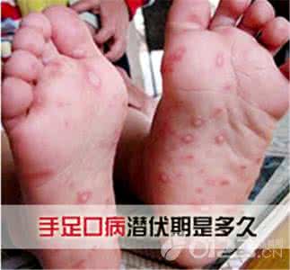 初期手足口病症状 手足口病怎么预防?手足口病初期症状