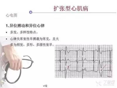 病毒性心肌炎怎么引起 心肌炎是什么病 心肌炎是怎么引起的