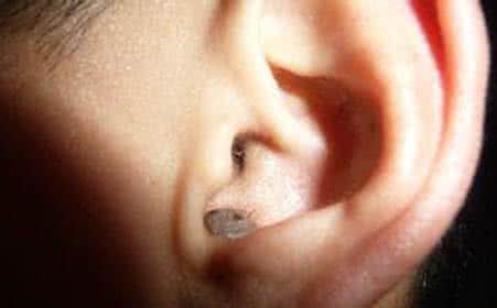 耳朵口长毛是什么征兆 耳朵口长毛是什么征兆 孕肚长毛是要生男宝的征兆吗？让妇产科医生告诉你