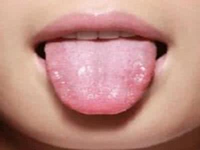 骨科常见疾病 舌头上有裂纹 常见骨科疾病有哪些