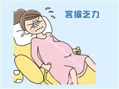 经产妇宫缩乏力的原因 什么是宫缩乏力
