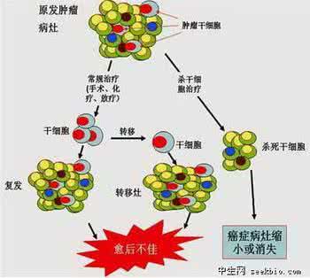 肿瘤干细胞治疗癌症 日本研究员成功消灭肿瘤干细胞 或促根治癌症