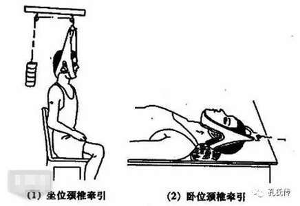 颈椎病患者的中医治疗 必看-经验告诉你颈椎病患者需要注意的问题