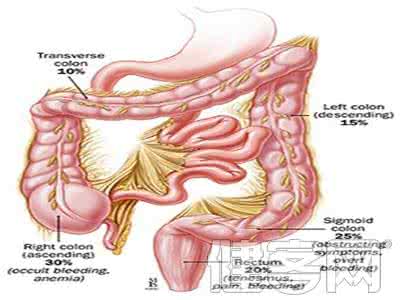 便秘是肠癌的早期症状 便秘是肠癌的早期症状 便秘的早期症状“面面观”