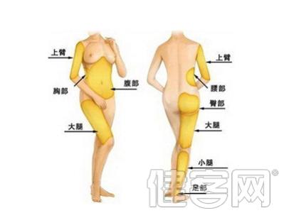 光纤吸脂减肥术哪家好 气功能减肥吗 点穴减肥术快速吸脂
