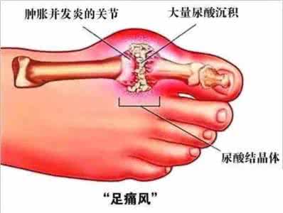 年轻人血液粘稠的原因 年轻人三高 年轻人别大意,血液粘稠问题大,清血管防三高要会这么吃