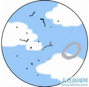 飞蚊症用药 眼前飞蚊 用药熏熏